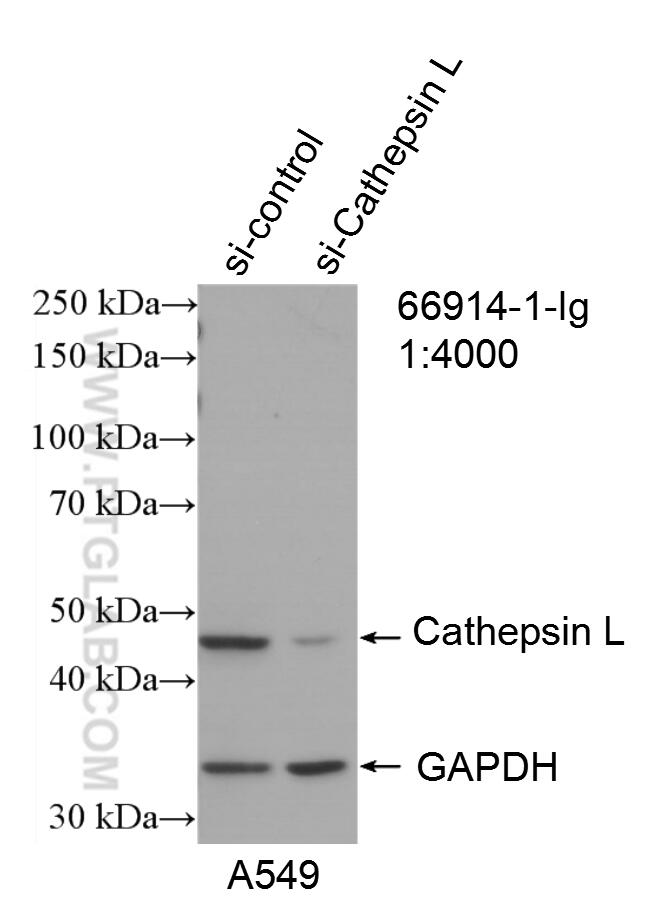 Cathepsin L Monoclonal antibody