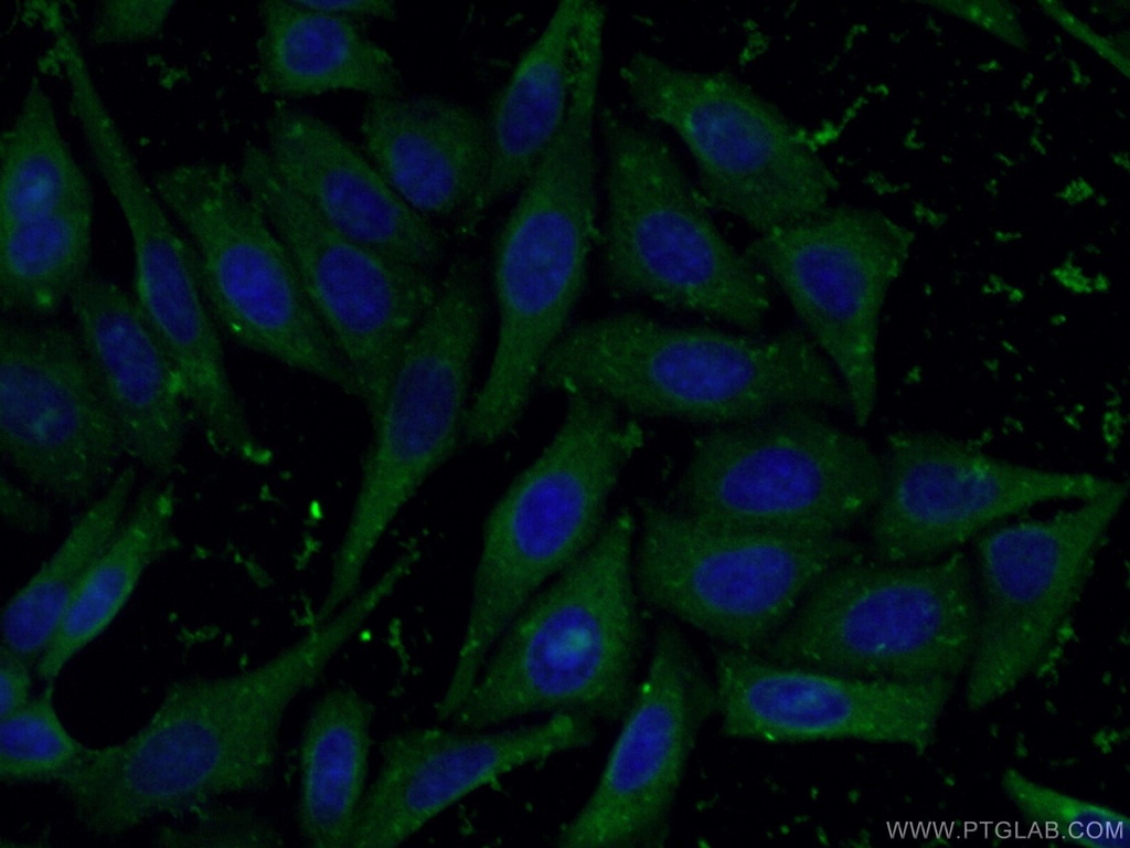 NFATC2 Monoclonal antibody