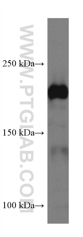 Integrin Beta 4 Monoclonal antibody