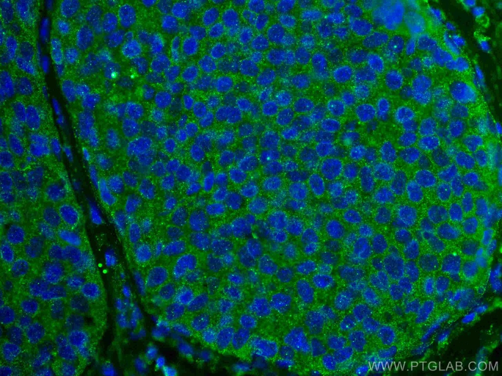 ROR1 Monoclonal antibody
