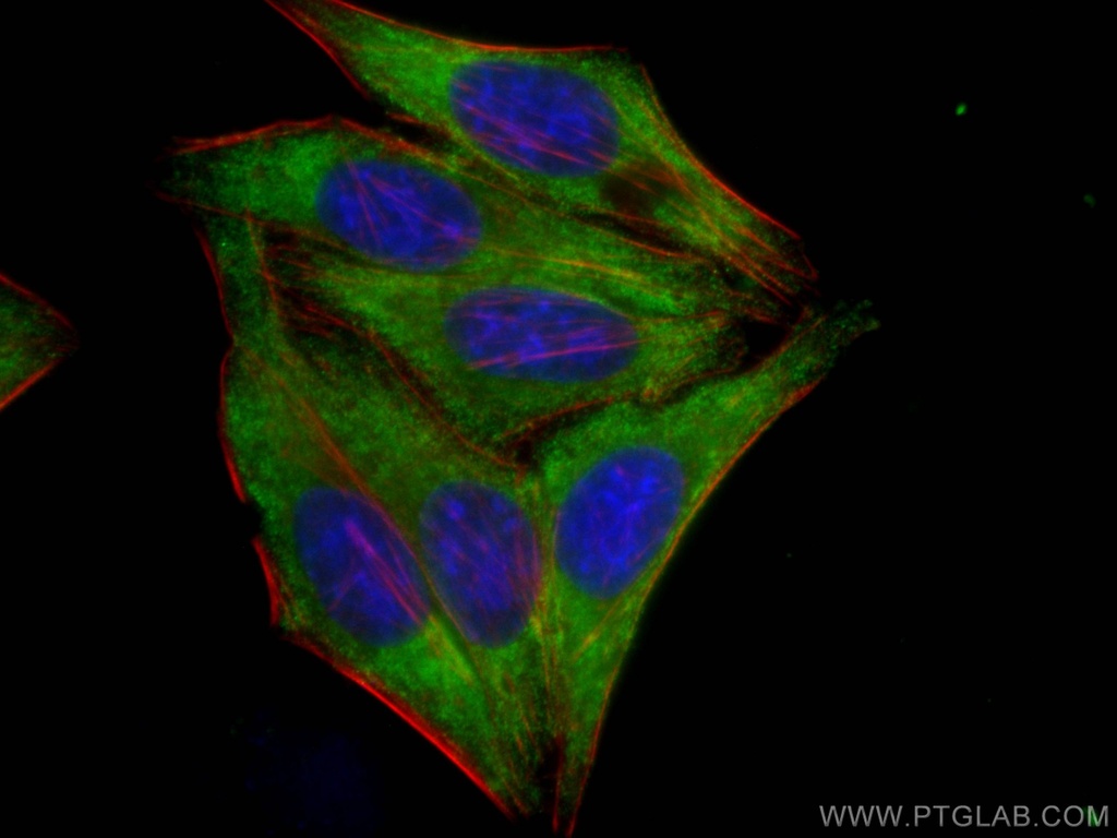 PPARG Monoclonal antibody