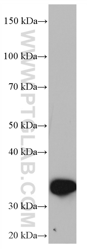 ZFP36 Monoclonal antibody