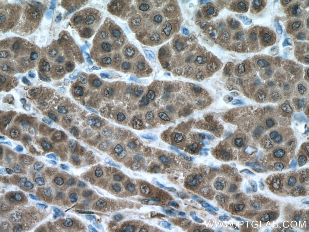 ADH1B Monoclonal antibody
