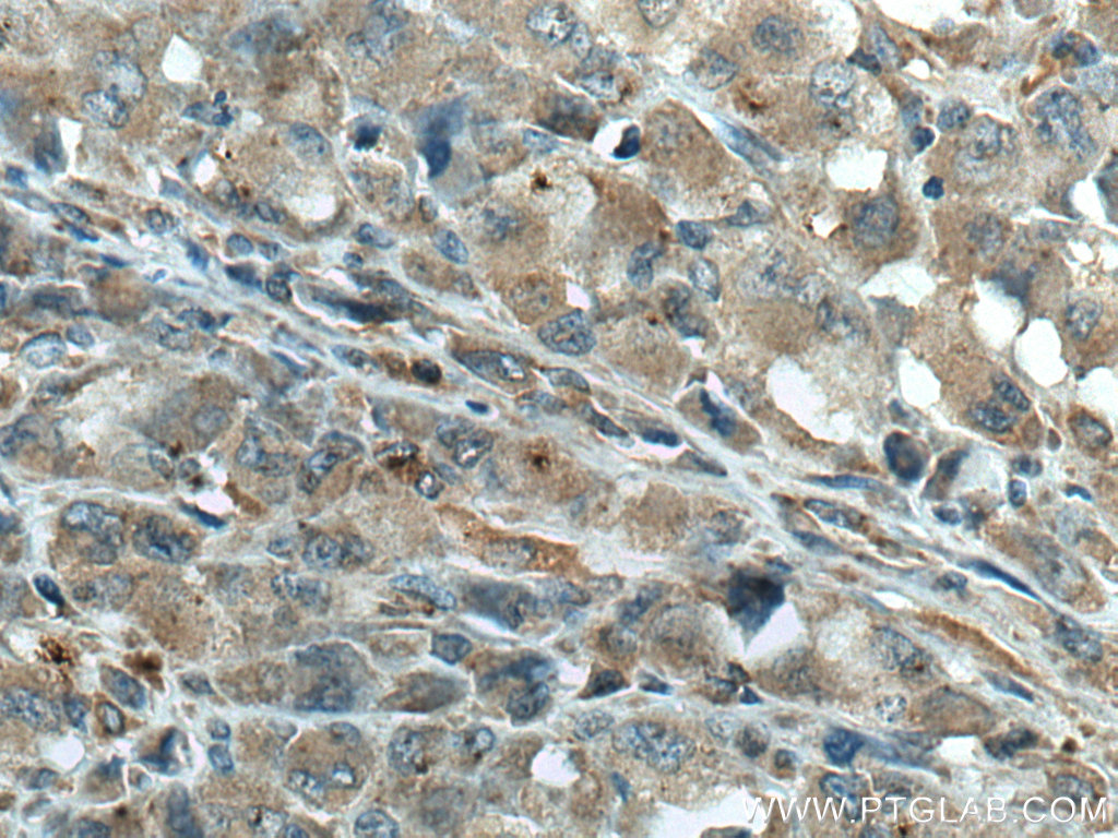 GIMAP5 Monoclonal antibody