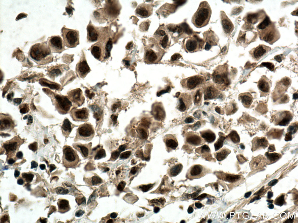 CDK4 Monoclonal antibody