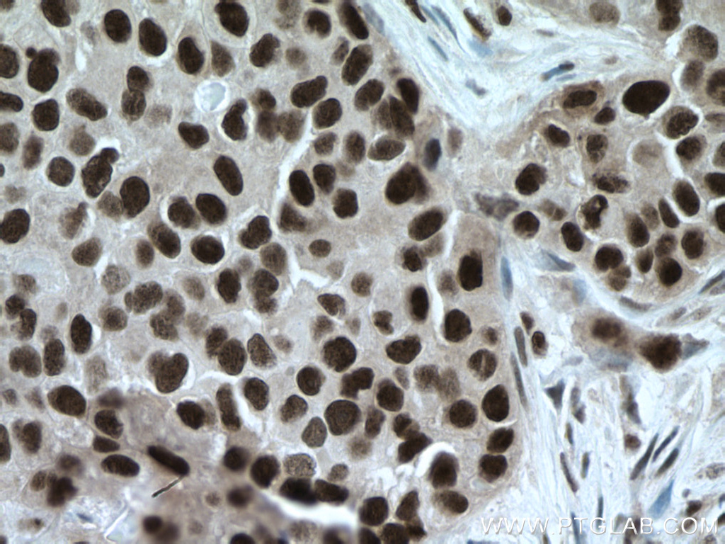 TBL1X Monoclonal antibody