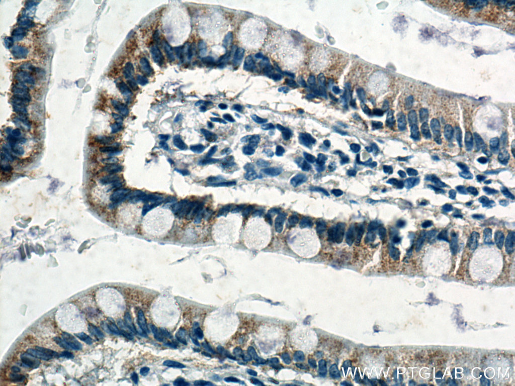 NOTUM Monoclonal antibody