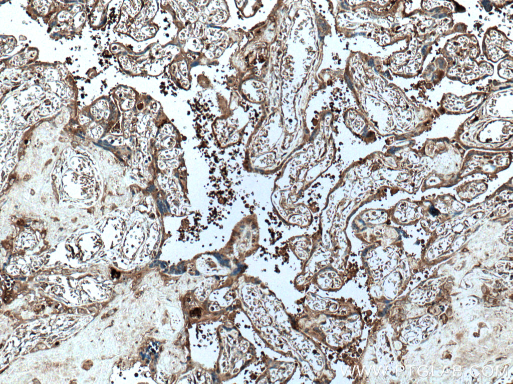 PAPPA Monoclonal antibody