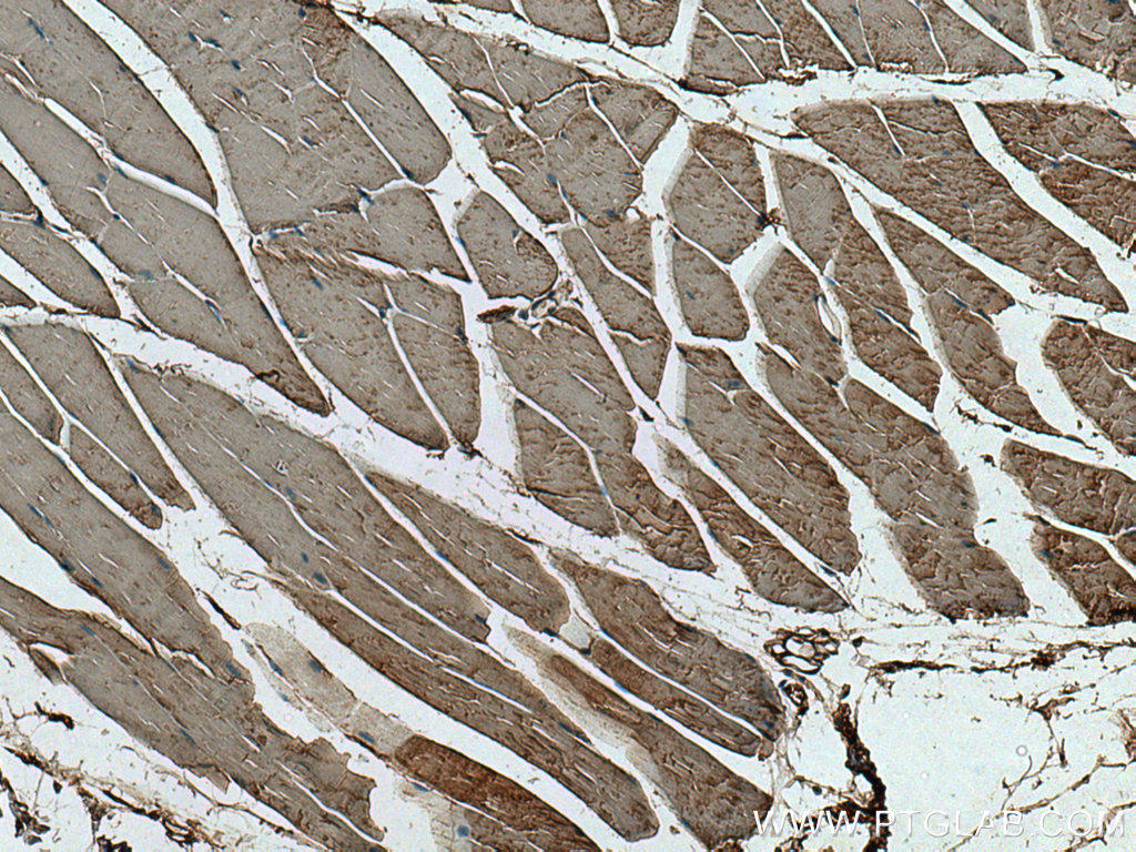 HK2 Monoclonal antibody