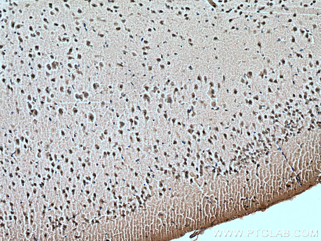FOX2/RBM9 Monoclonal antibody