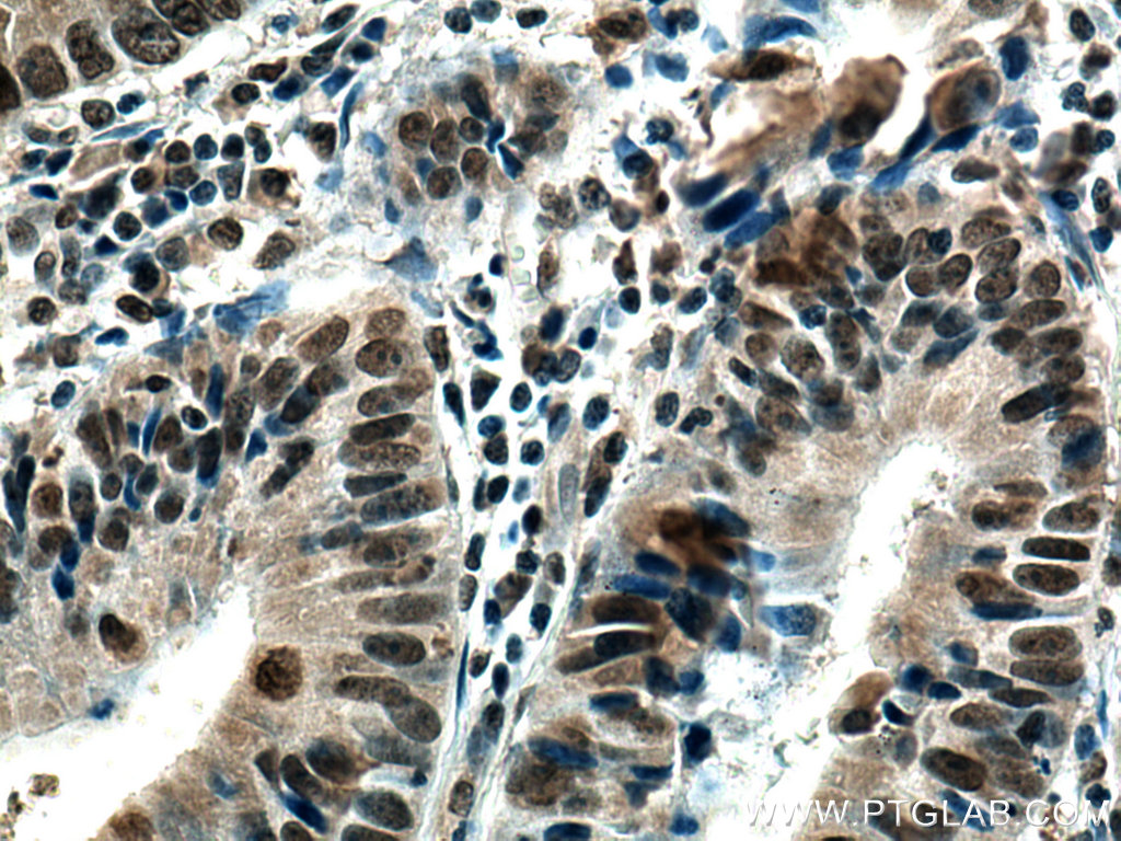 SMC1A Monoclonal antibody