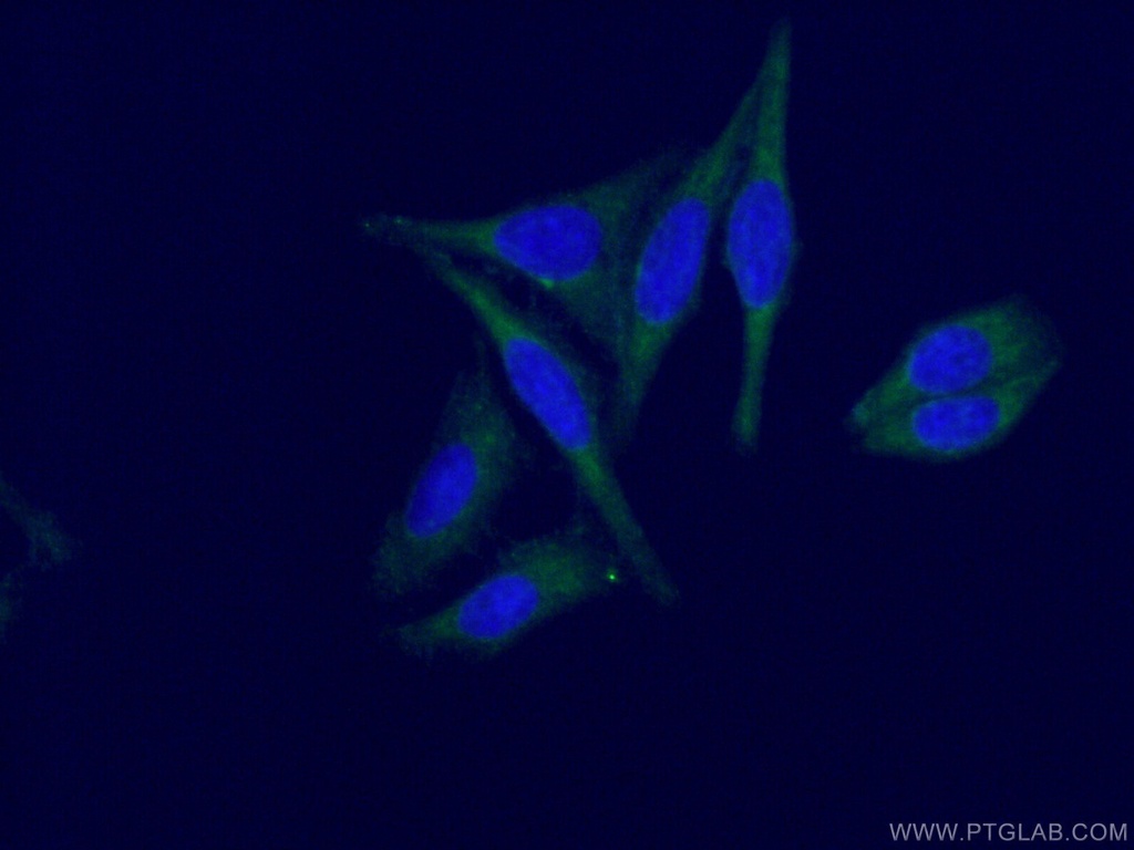 LHPP Monoclonal antibody