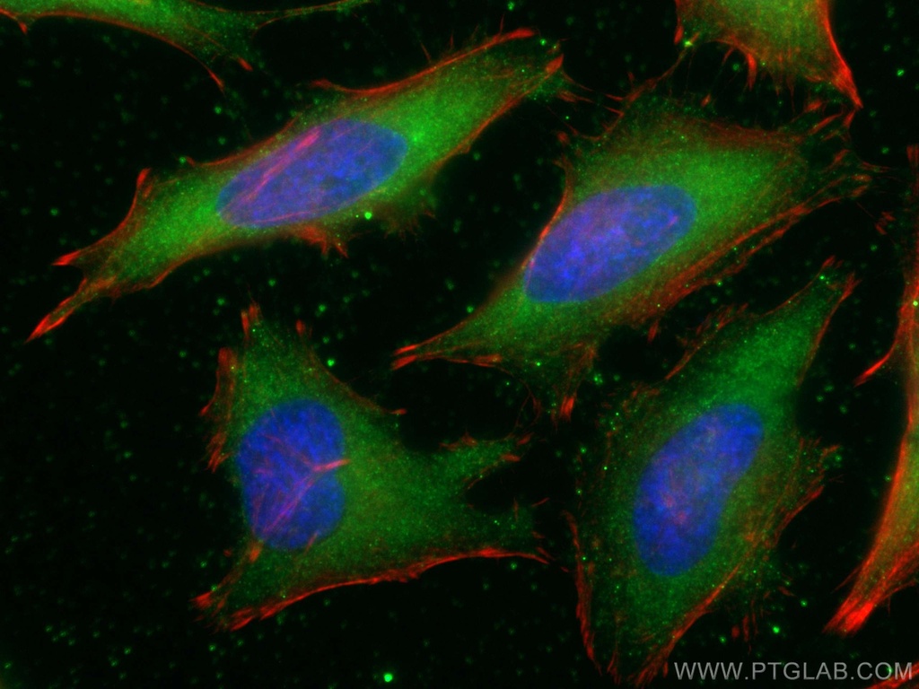 hIST1 Monoclonal antibody