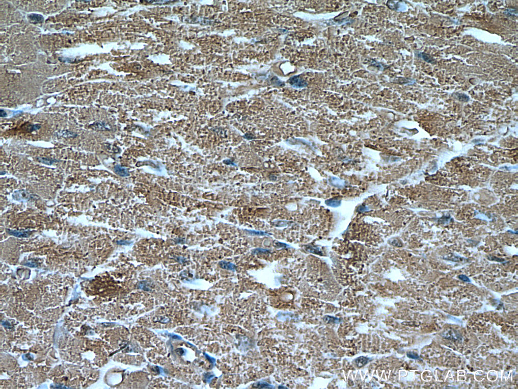 UBAP1 Monoclonal antibody
