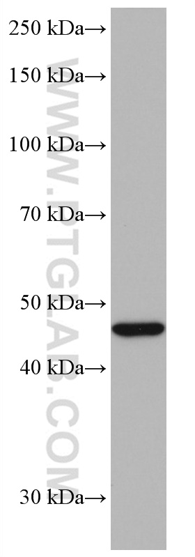 Neuroserpin Monoclonal antibody