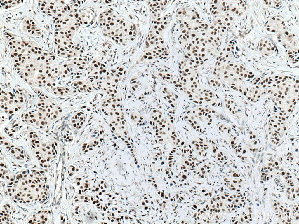 NUP50 Monoclonal antibody
