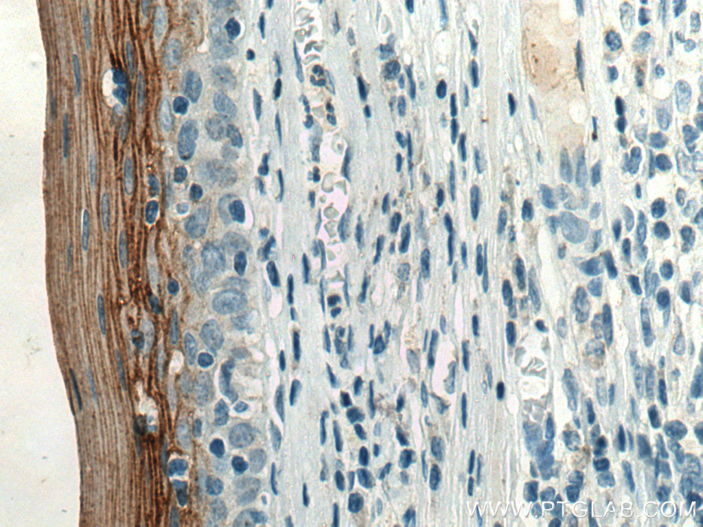 TGM1 Monoclonal antibody