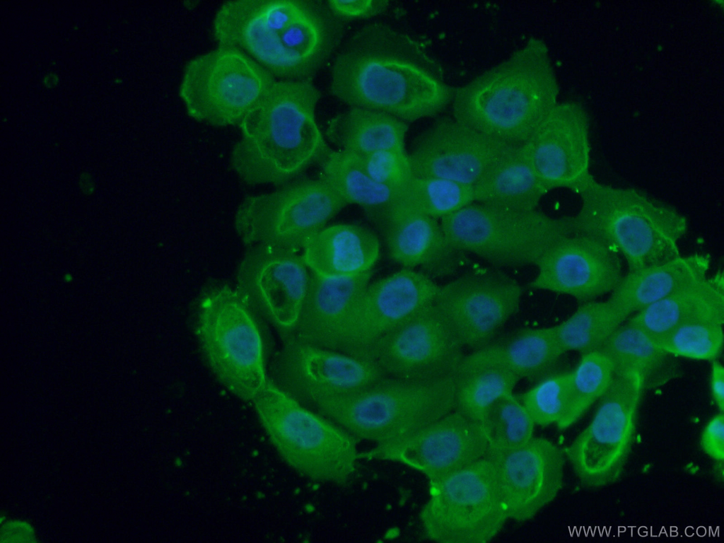 GNAI2 Monoclonal antibody