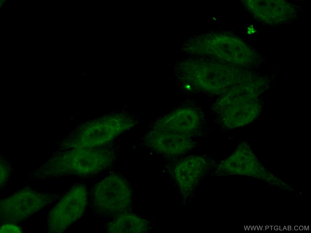 NEIL1 Monoclonal antibody
