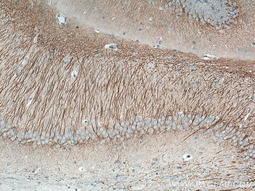 MAP2 Monoclonal antibody