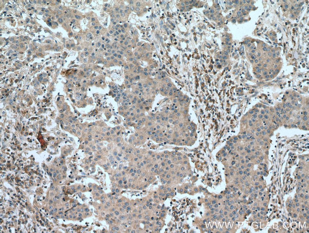 COMMD1 Monoclonal antibody