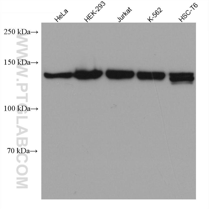 TIMELESS Monoclonal antibody