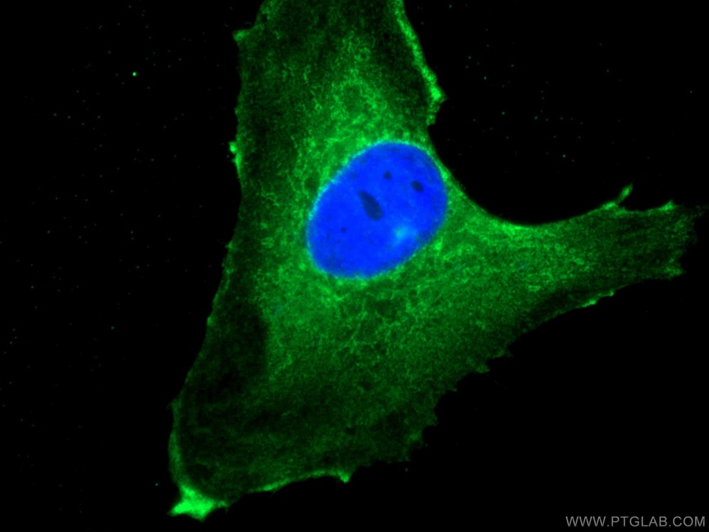 NEU1 Monoclonal antibody