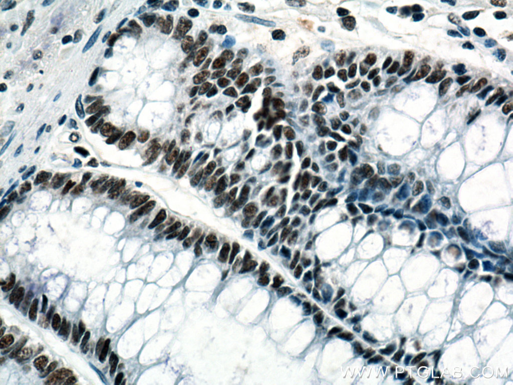 KDM1 Monoclonal antibody