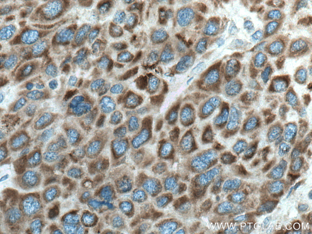 CYP27A1 Monoclonal antibody