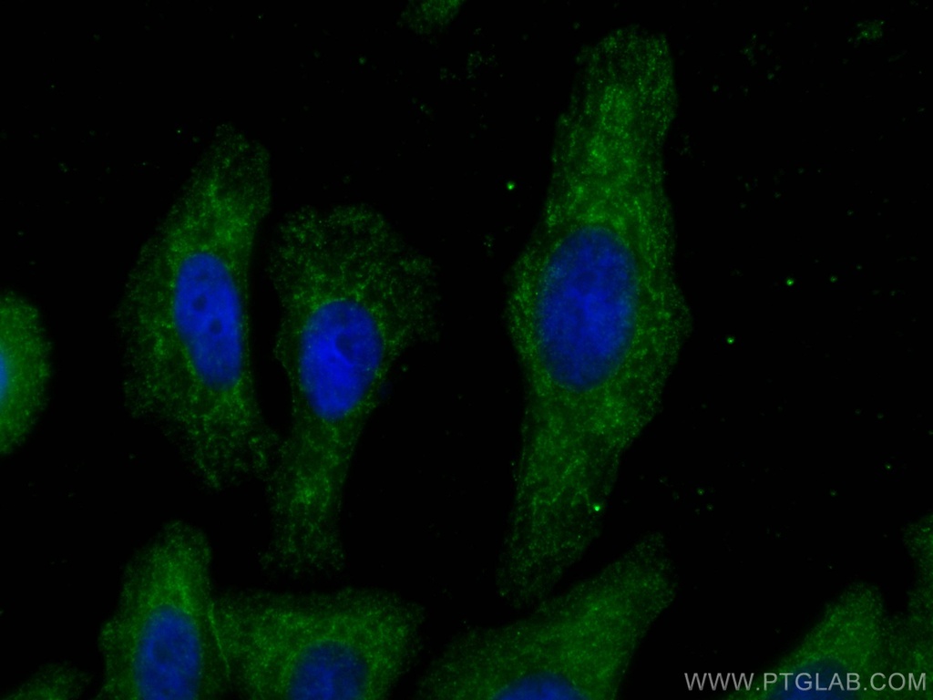 C1QA Monoclonal antibody