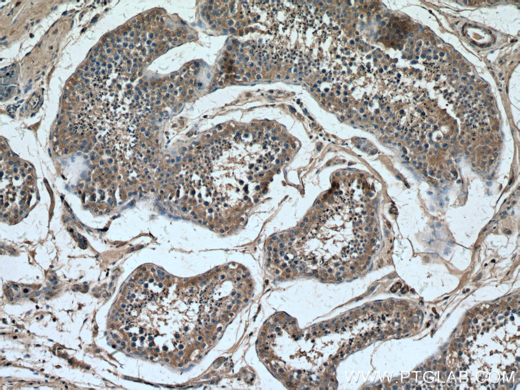 PLCD1 Monoclonal antibody