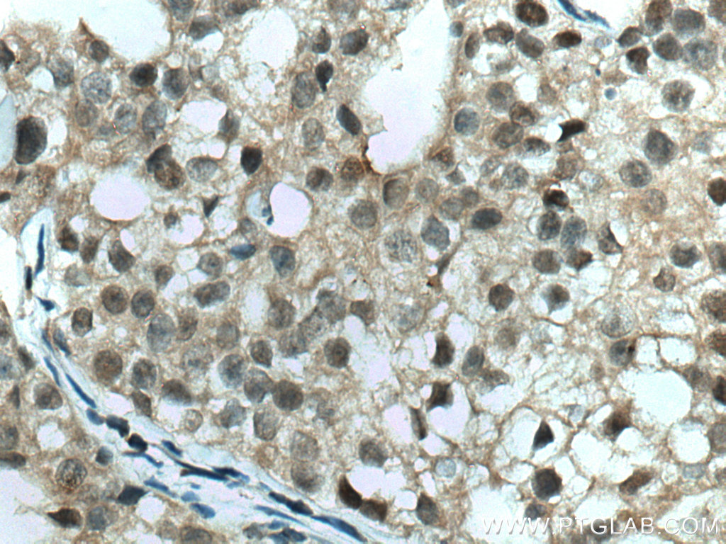 TFAP2A,AP-2 Monoclonal antibody
