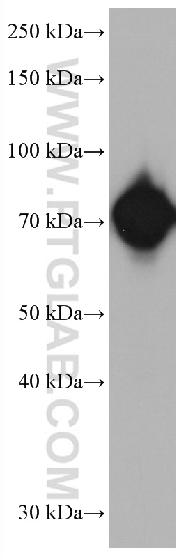 RUNX1T1 Monoclonal antibody