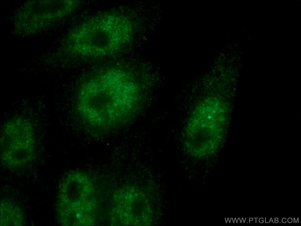HORMAD1 Monoclonal antibody