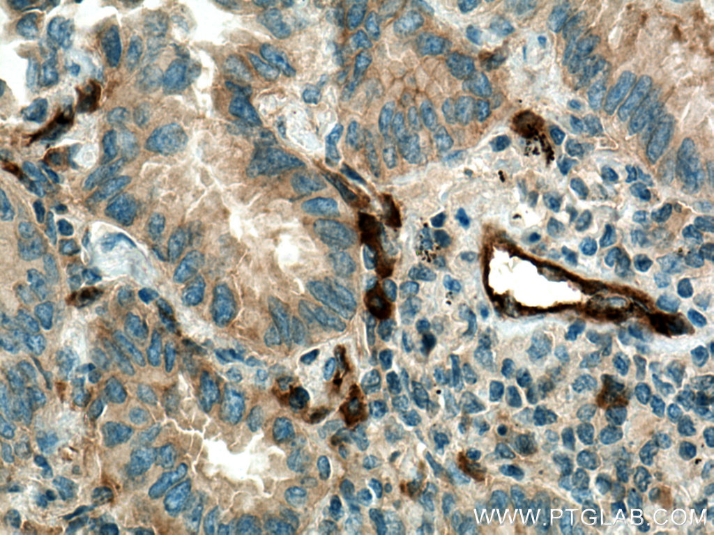 RALB Monoclonal antibody
