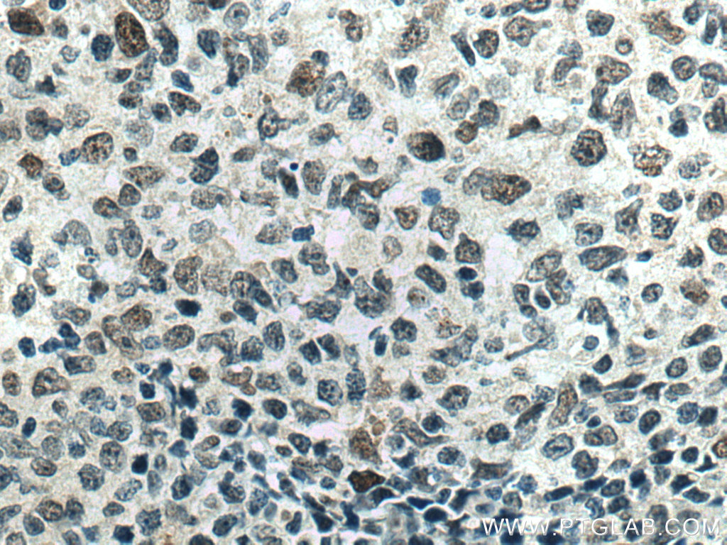 MAD2L2 Monoclonal antibody