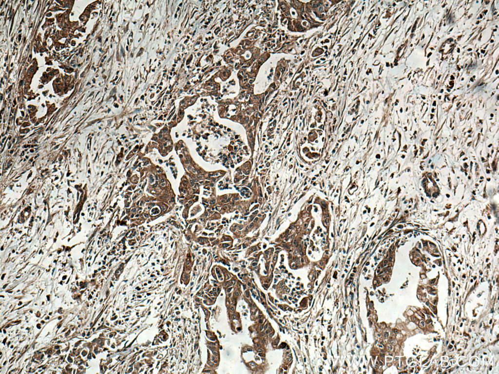 INA Monoclonal antibody