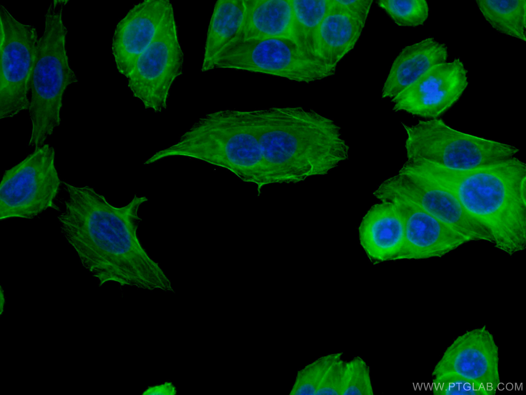 FLNA Monoclonal antibody