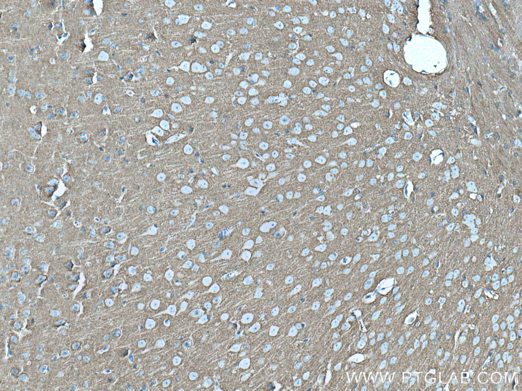 STXBP1 Monoclonal antibody