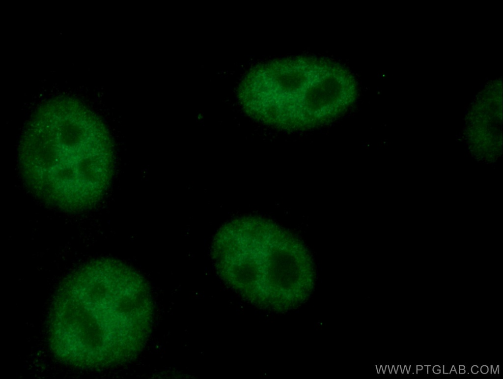 TCF3 Monoclonal antibody