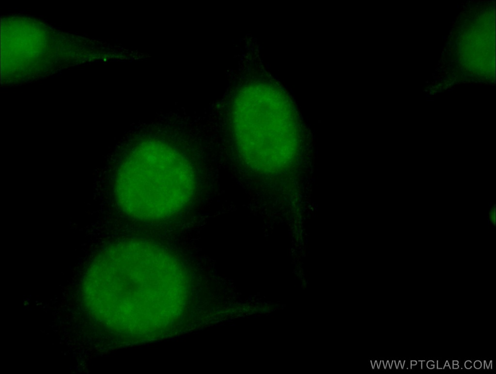DHX9 Monoclonal antibody