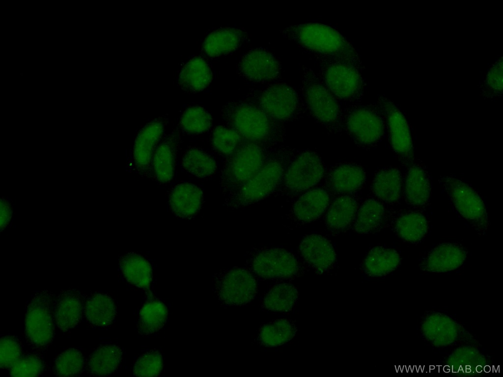 SUMO2/3 Monoclonal antibody