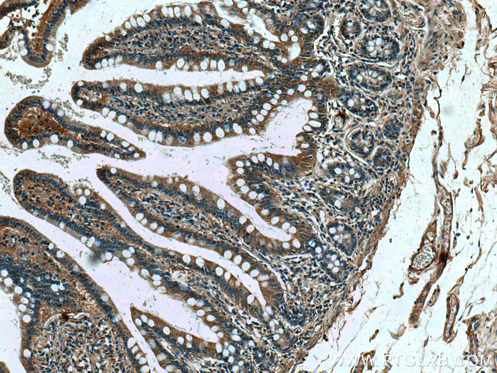 DEFA1 Monoclonal antibody