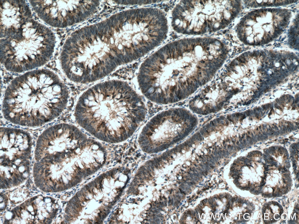 HIP1 Monoclonal antibody