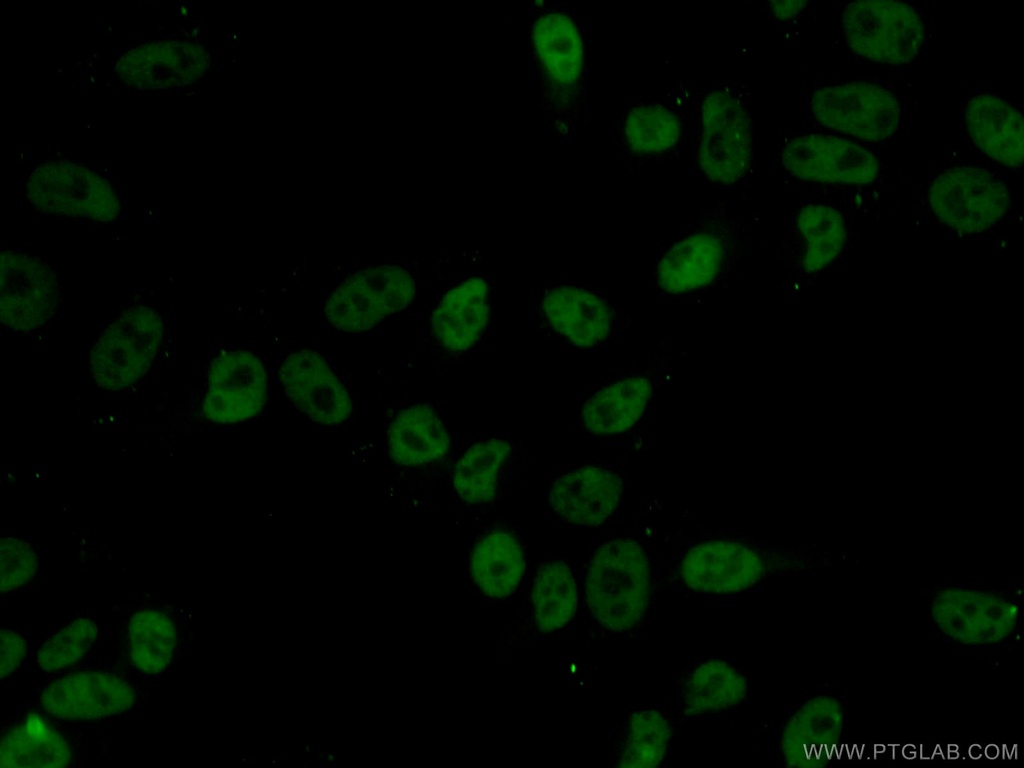 HDAC2 Monoclonal antibody