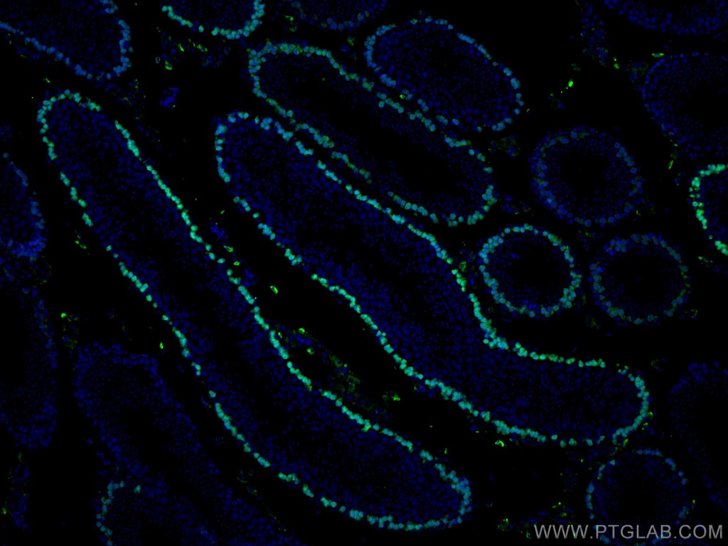DMC1 Monoclonal antibody