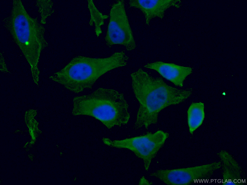 KIF20A Monoclonal antibody