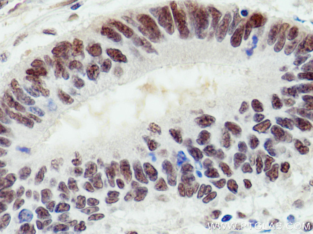 UBE1 Monoclonal antibody