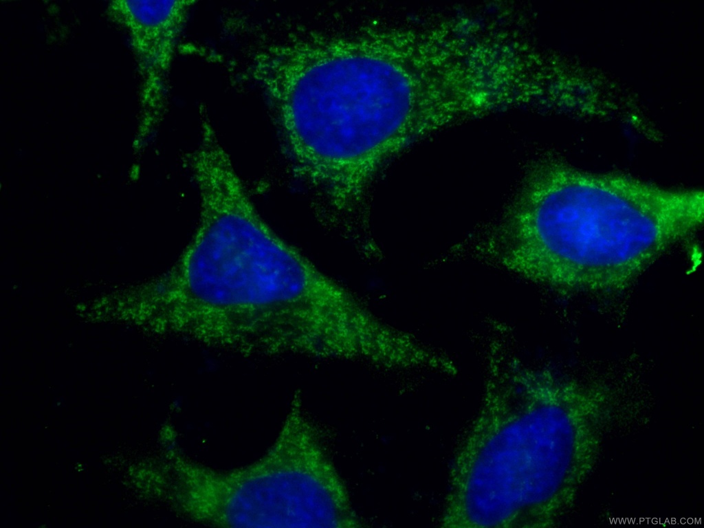 WNT10B Monoclonal antibody
