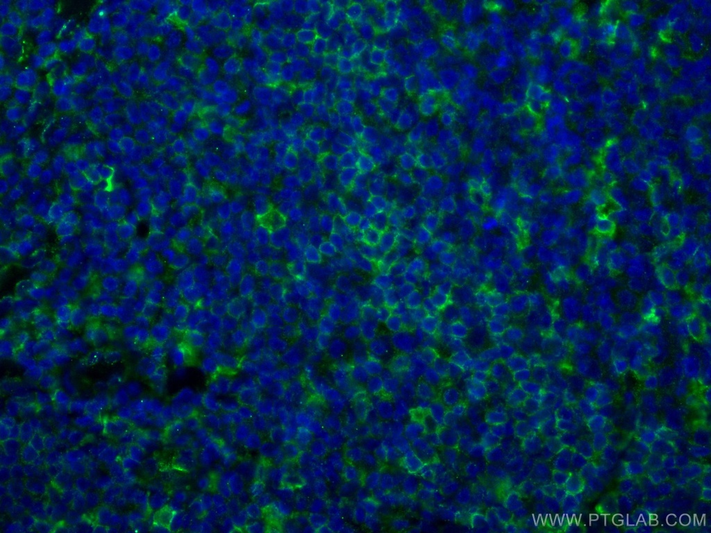 LAIR1 Monoclonal antibody